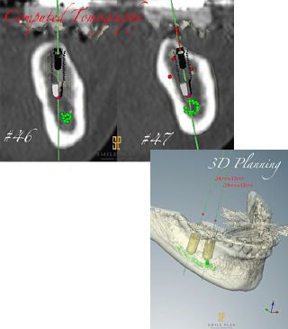 3D Planning