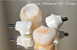 Zirconia Alutment Crown