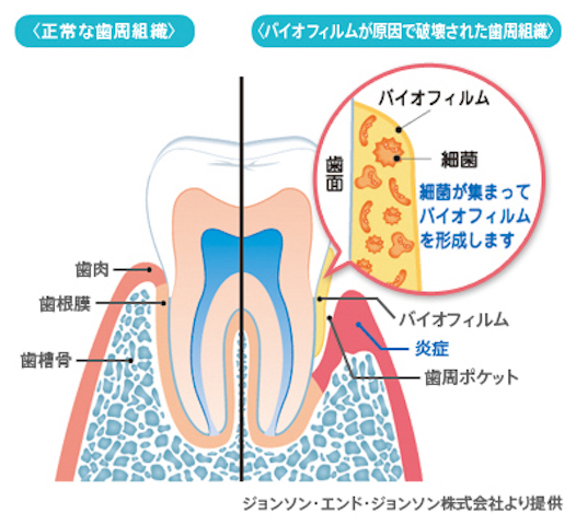 illust1