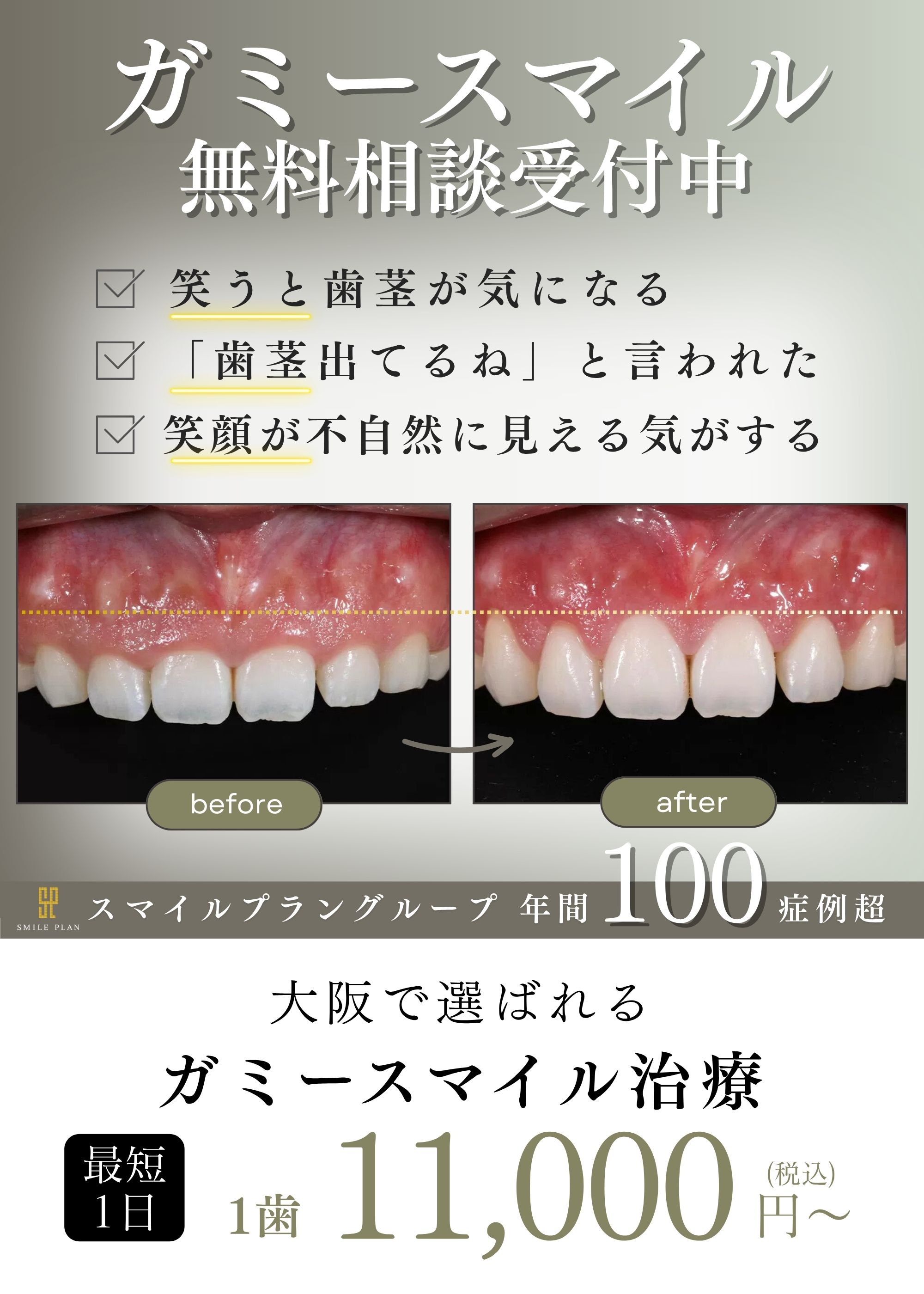JR茨木駅のガミースマイル名医・最短1日1万円